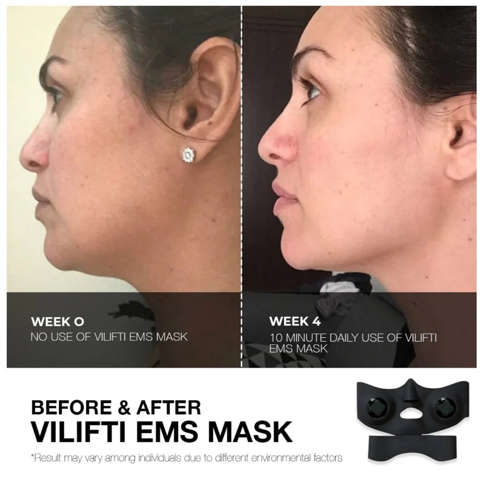 BEAUTY LIFTING MASK - FACEGYM VILIFTI EMS Face Mask for Lifting and Contouring